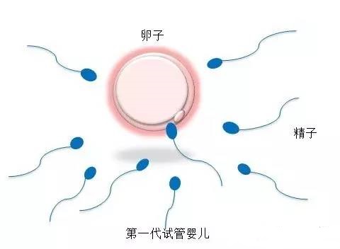 关于供精代怀价格供卵